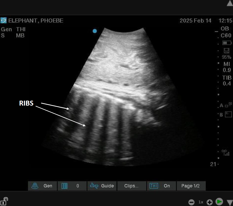 ultrasound