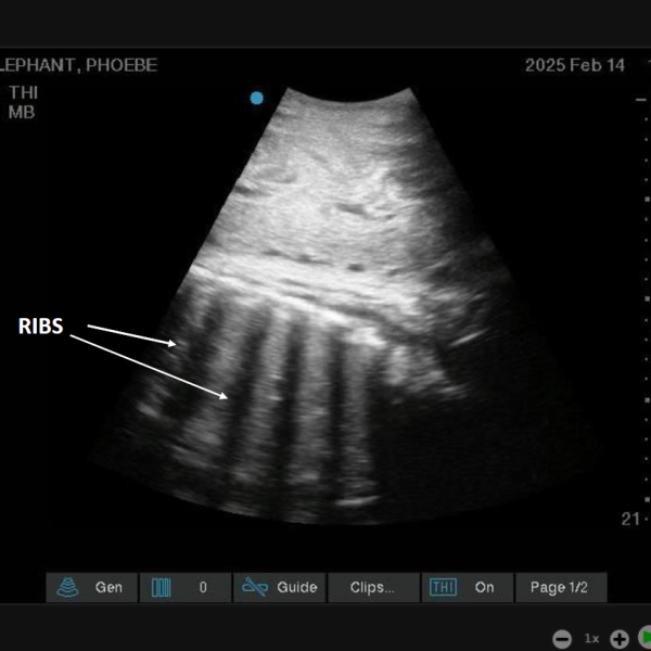 baby ultrasound