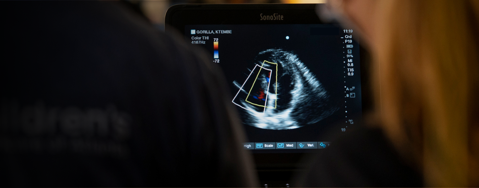 ultrasound of heart